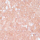 Immunohistochemistry - Anti-ARHGAP4 Antibody (A308756) - Antibodies.com