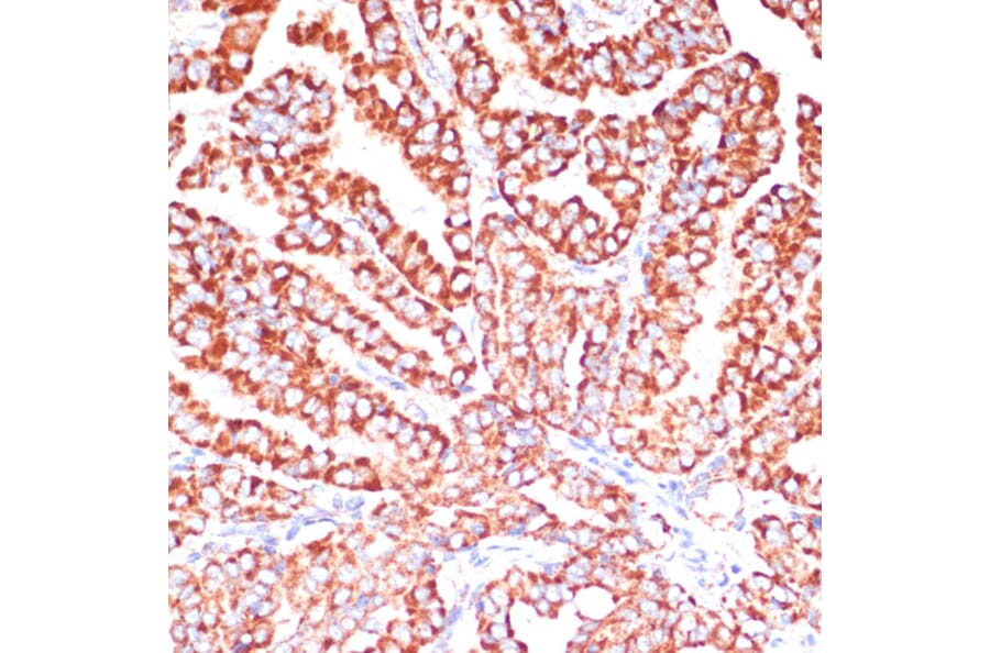 Immunohistochemistry - Anti-ARHGAP4 Antibody (A308756) - Antibodies.com