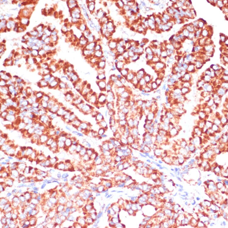 Immunohistochemistry - Anti-ARHGAP4 Antibody (A308756) - Antibodies.com