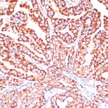 Immunohistochemistry - Anti-ARHGAP4 Antibody (A308756) - Antibodies.com