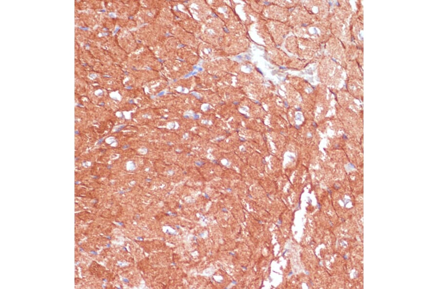 Immunohistochemistry - Anti-ARHGAP4 Antibody (A308756) - Antibodies.com