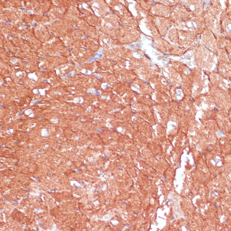 Immunohistochemistry - Anti-ARHGAP4 Antibody (A308756) - Antibodies.com