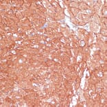 Immunohistochemistry - Anti-ARHGAP4 Antibody (A308756) - Antibodies.com