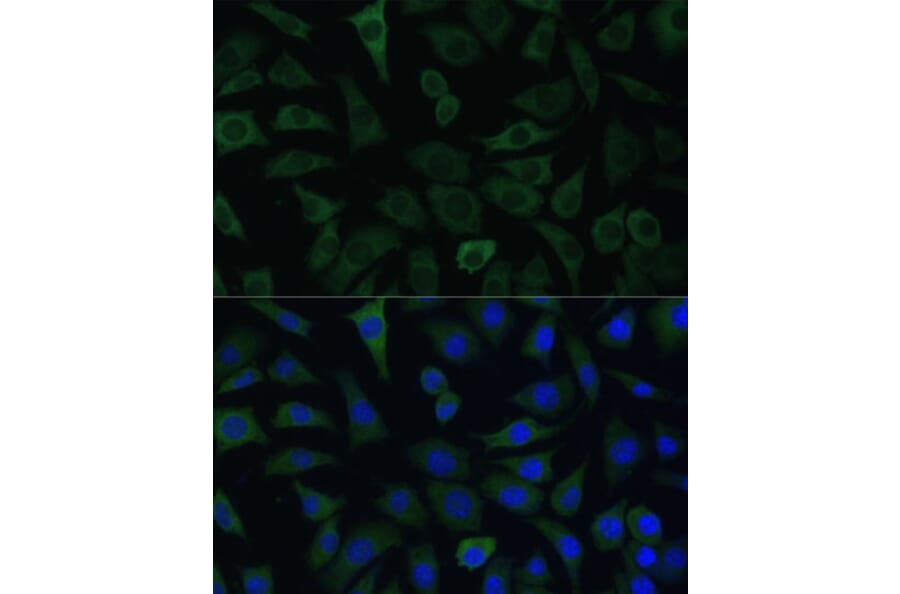 Immunofluorescence - Anti-ARHGAP4 Antibody (A308756) - Antibodies.com