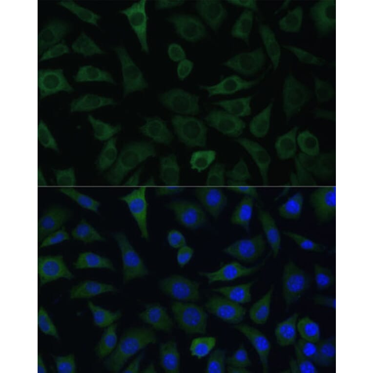 Immunofluorescence - Anti-ARHGAP4 Antibody (A308756) - Antibodies.com