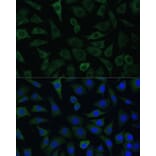 Immunofluorescence - Anti-ARHGAP4 Antibody (A308756) - Antibodies.com