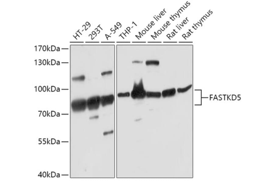 Western Blot - Anti-FASTKD5 Antibody (A308757) - Antibodies.com