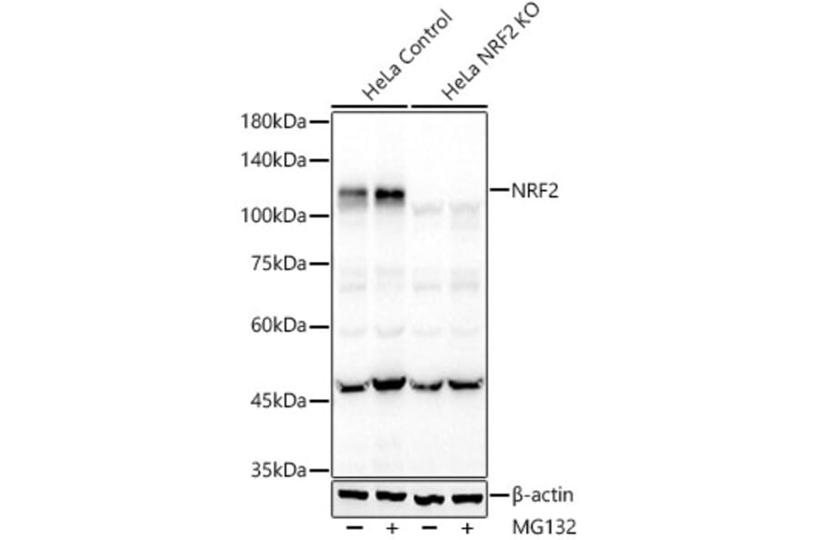 Western Blot - Anti-Nrf2 Antibody [ARC50393] (A308758) - Antibodies.com