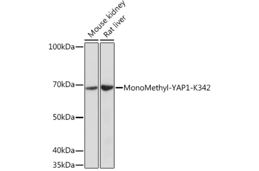 Western Blot - Anti-YAP1 (mono methyl Lys342) Antibody (A308759) - Antibodies.com