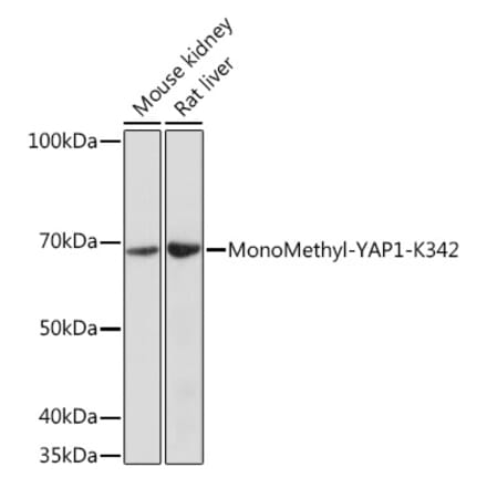 Western Blot - Anti-YAP1 (mono methyl Lys342) Antibody (A308759) - Antibodies.com