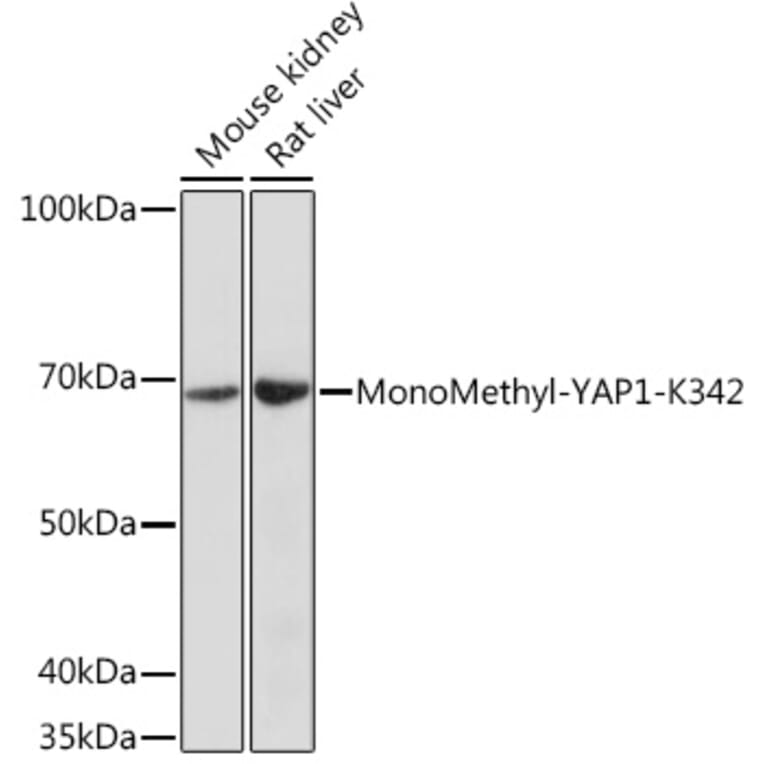 Western Blot - Anti-YAP1 (mono methyl Lys342) Antibody (A308759) - Antibodies.com