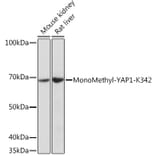 Western Blot - Anti-YAP1 (mono methyl Lys342) Antibody (A308759) - Antibodies.com