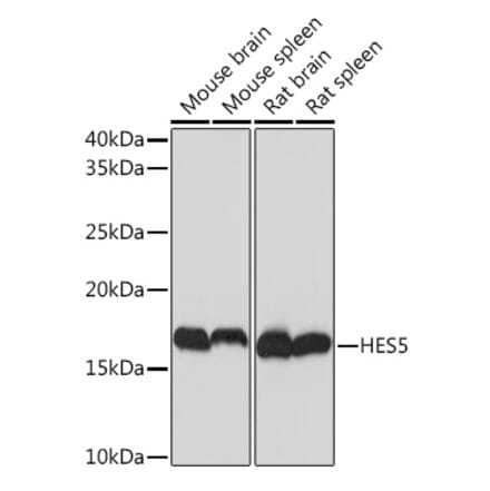 Western Blot - Anti-HES5 Antibody [ARC1740] (A308760) - Antibodies.com