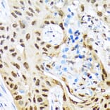 Immunohistochemistry - Anti-HES5 Antibody [ARC1740] (A308760) - Antibodies.com