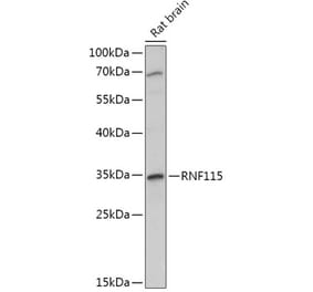 Western Blot - Anti-RNF115 Antibody (A308761) - Antibodies.com