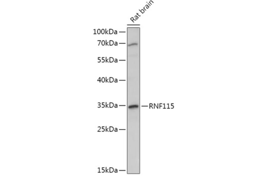 Western Blot - Anti-RNF115 Antibody (A308761) - Antibodies.com