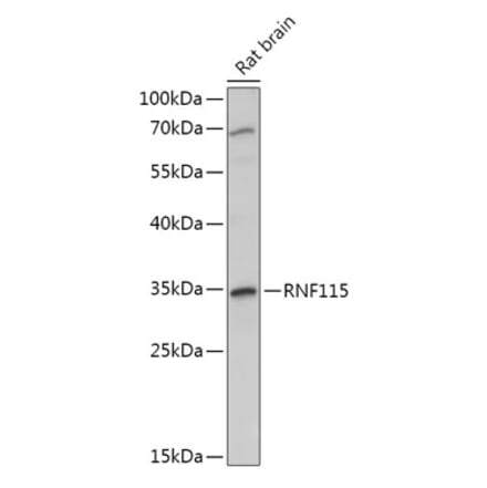 Western Blot - Anti-RNF115 Antibody (A308761) - Antibodies.com