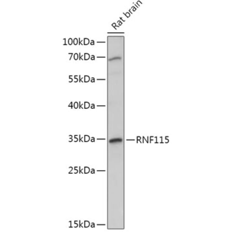 Western Blot - Anti-RNF115 Antibody (A308761) - Antibodies.com