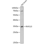 Western Blot - Anti-RNF115 Antibody (A308761) - Antibodies.com