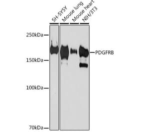 Western Blot - Anti-PDGFR beta Antibody [ARC0009] (A308762) - Antibodies.com