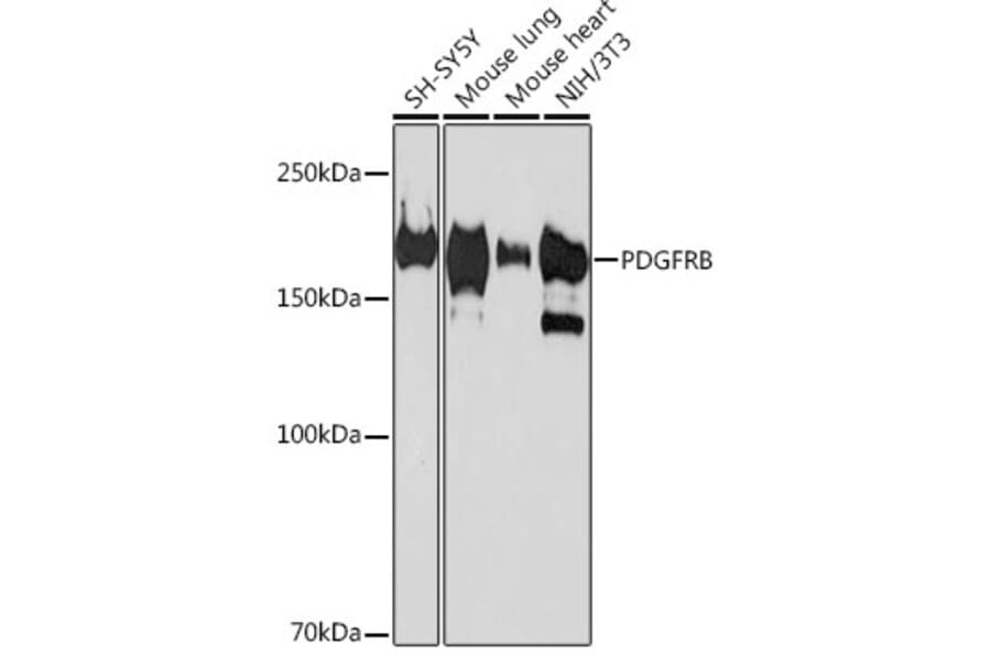 Western Blot - Anti-PDGFR beta Antibody [ARC0009] (A308762) - Antibodies.com