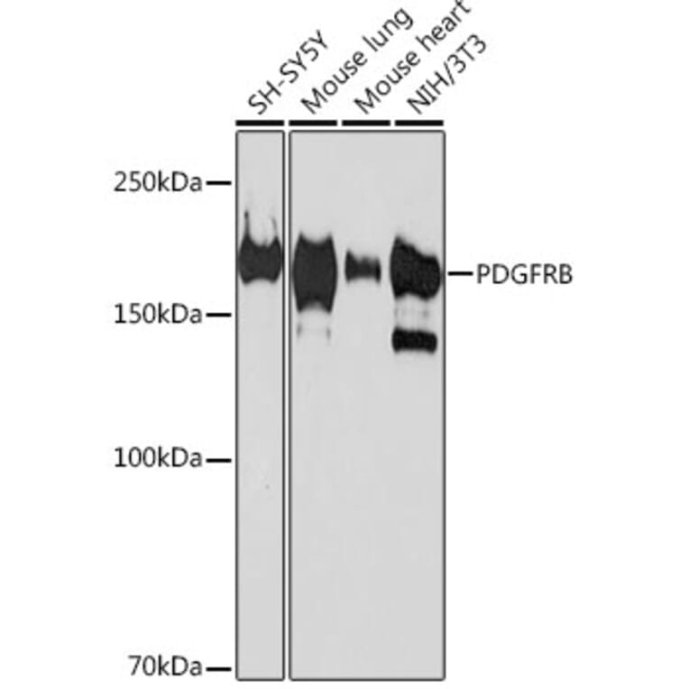 Western Blot - Anti-PDGFR beta Antibody [ARC0009] (A308762) - Antibodies.com