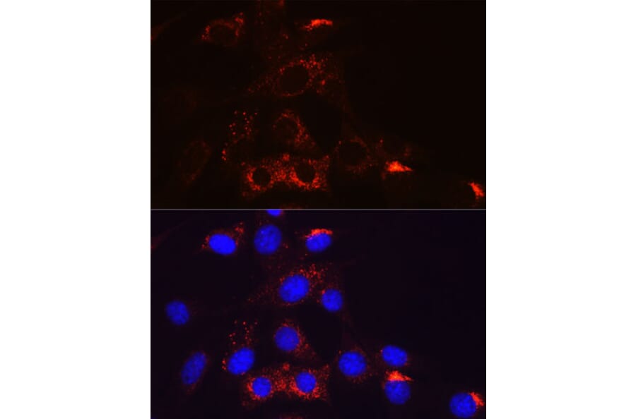 Immunofluorescence - Anti-PDGFR beta Antibody [ARC0009] (A308762) - Antibodies.com