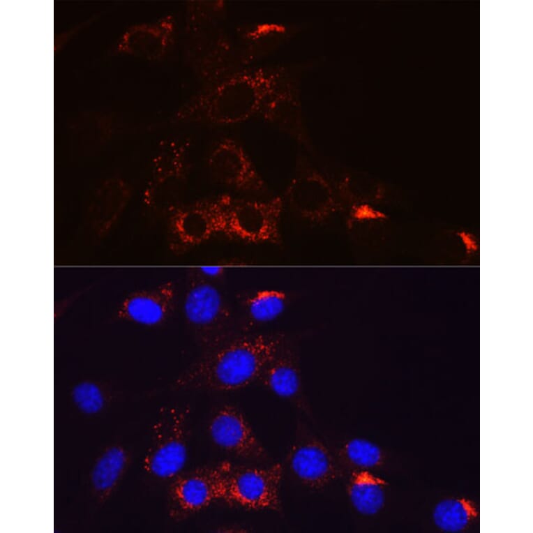 Immunofluorescence - Anti-PDGFR beta Antibody [ARC0009] (A308762) - Antibodies.com