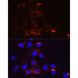 Immunofluorescence - Anti-PDGFR beta Antibody [ARC0009] (A308762) - Antibodies.com