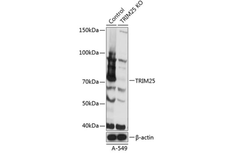 Western Blot - Anti-TRIM25 / EFP Antibody (A308764) - Antibodies.com