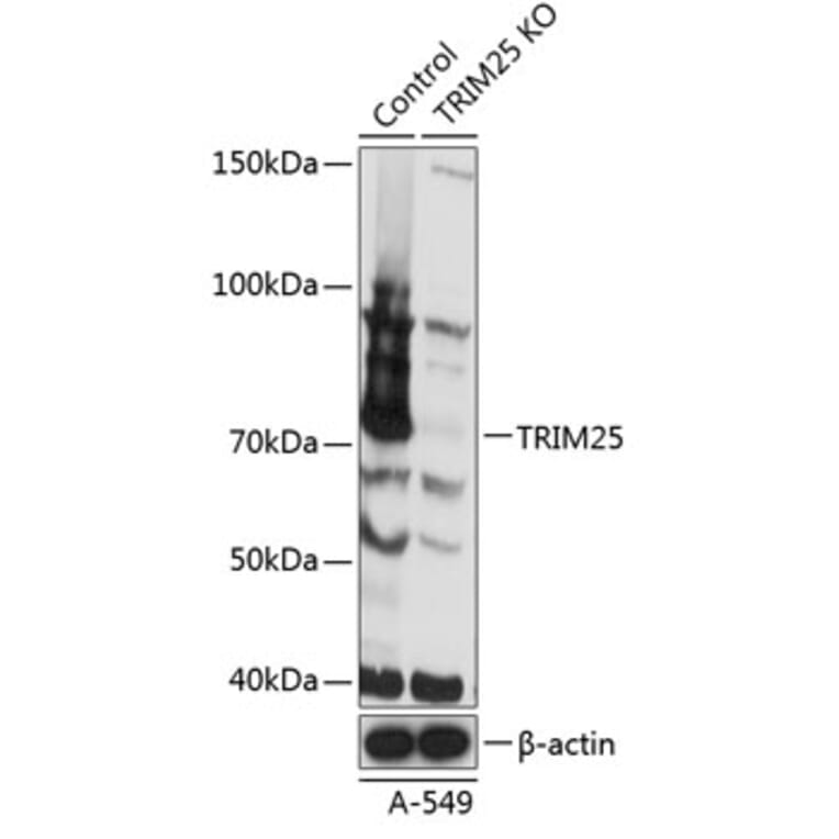 Western Blot - Anti-TRIM25 / EFP Antibody (A308764) - Antibodies.com
