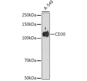 Western Blot - Anti-CD30 Antibody [ARC1750] (A308766) - Antibodies.com