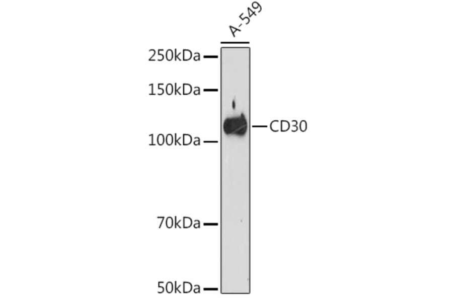 Western Blot - Anti-CD30 Antibody [ARC1750] (A308766) - Antibodies.com