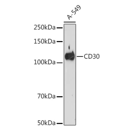 Western Blot - Anti-CD30 Antibody [ARC1750] (A308766) - Antibodies.com