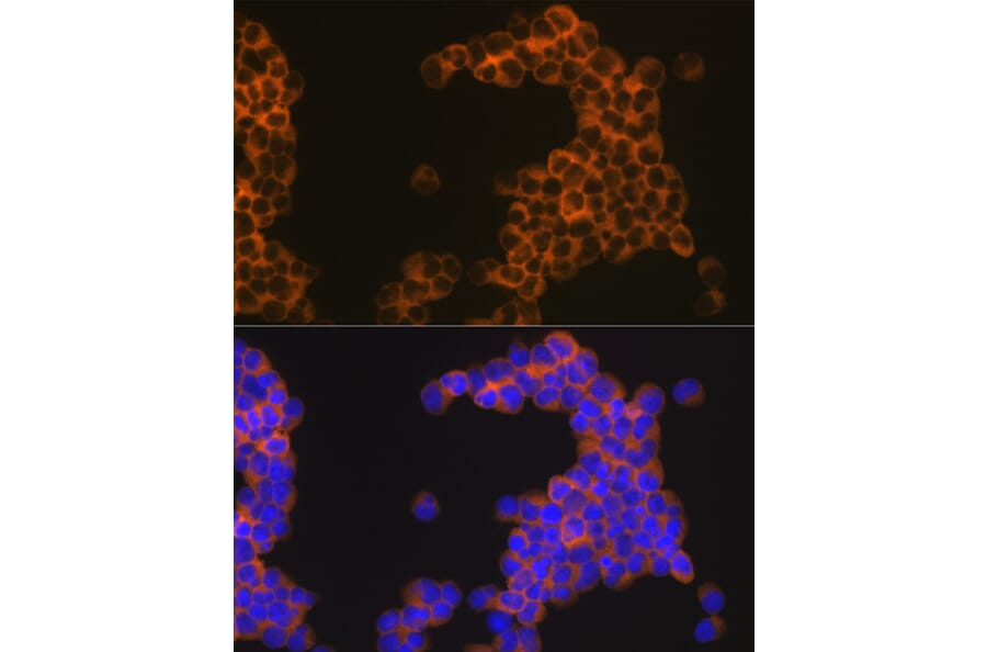 Immunofluorescence - Anti-CD30 Antibody [ARC1750] (A308766) - Antibodies.com