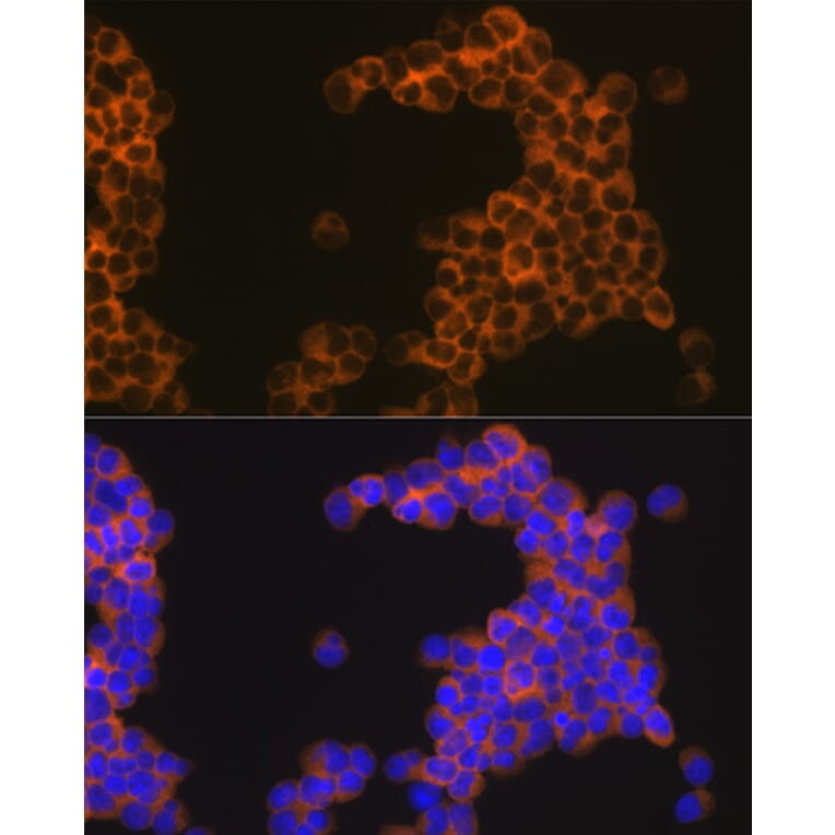 Immunofluorescence - Anti-CD30 Antibody [ARC1750] (A308766) - Antibodies.com