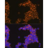 Immunofluorescence - Anti-CD30 Antibody [ARC1750] (A308766) - Antibodies.com