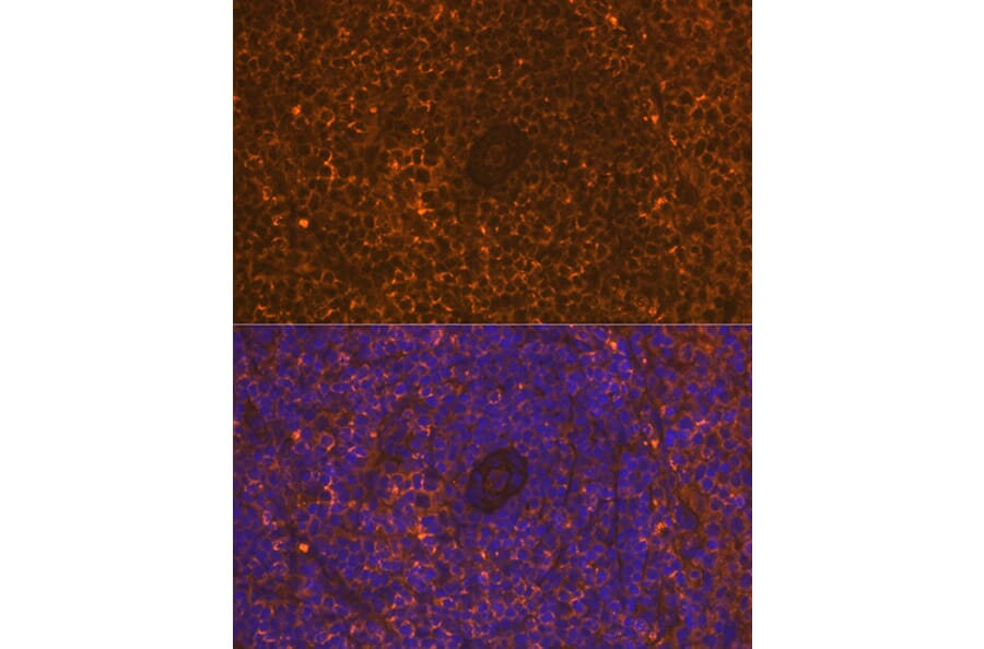 Immunofluorescence - Anti-CD30 Antibody [ARC1750] (A308766) - Antibodies.com
