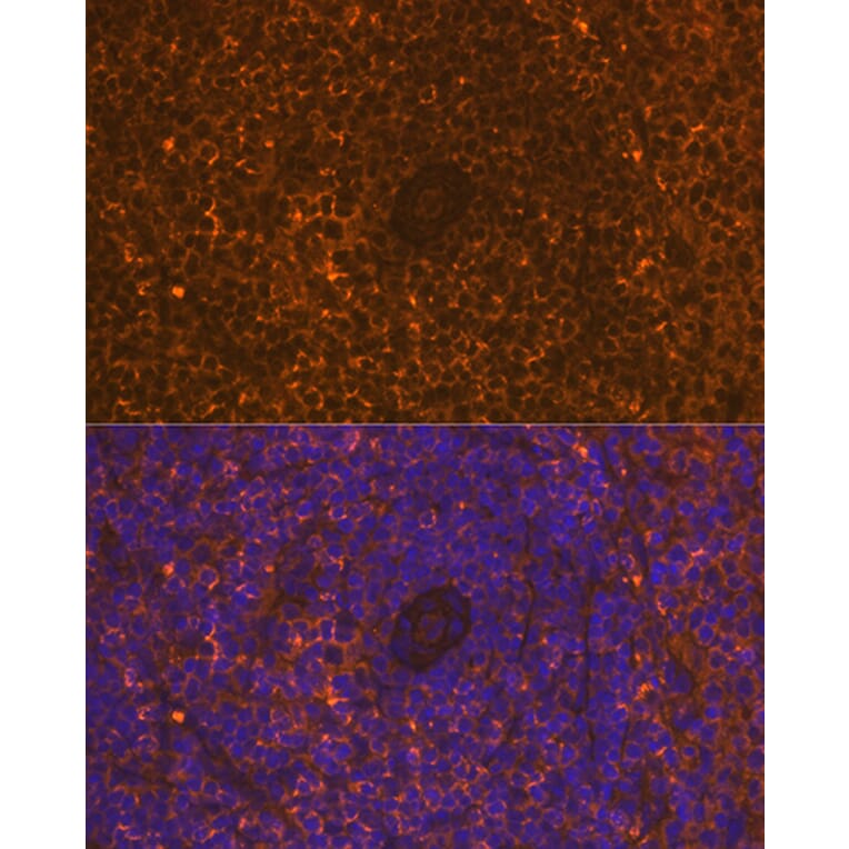 Immunofluorescence - Anti-CD30 Antibody [ARC1750] (A308766) - Antibodies.com