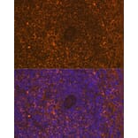 Immunofluorescence - Anti-CD30 Antibody [ARC1750] (A308766) - Antibodies.com