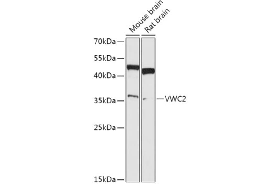 Western Blot - Anti-VWC2/BRORIN Antibody (A308767) - Antibodies.com