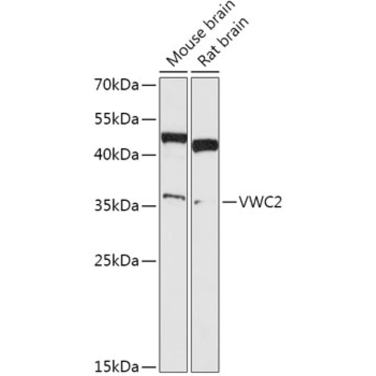 Western Blot - Anti-VWC2/BRORIN Antibody (A308767) - Antibodies.com
