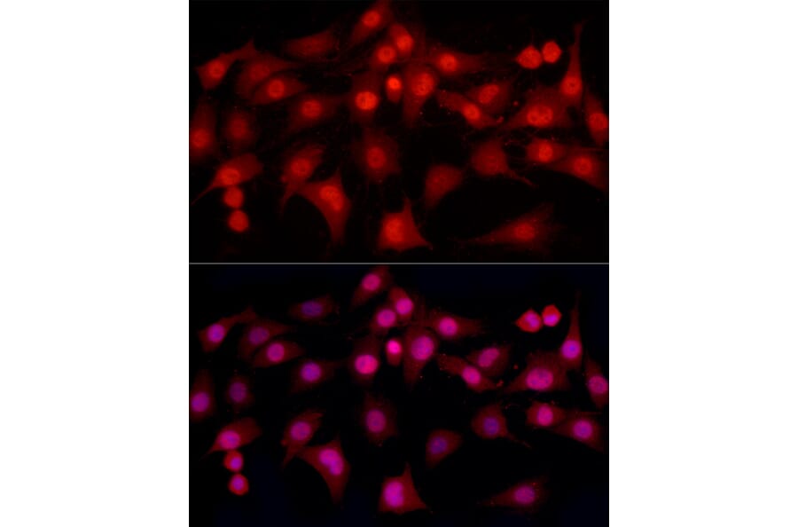 Immunofluorescence - Anti-Estrogen Receptor alpha Antibody (A308769) - Antibodies.com