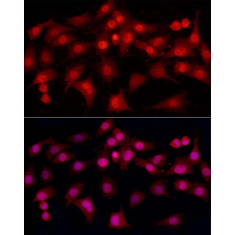 Immunofluorescence - Anti-Estrogen Receptor alpha Antibody (A308769) - Antibodies.com