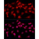 Immunofluorescence - Anti-Estrogen Receptor alpha Antibody (A308769) - Antibodies.com