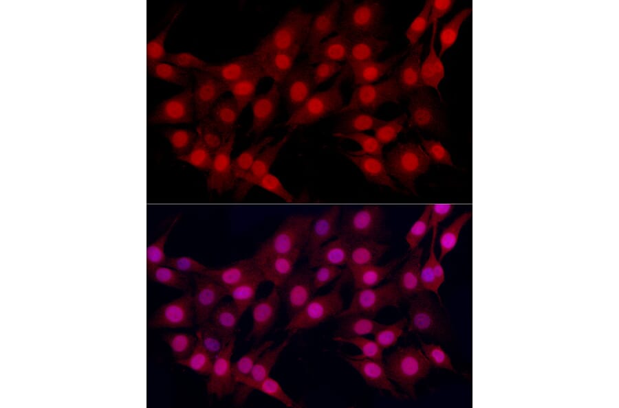 Immunofluorescence - Anti-Estrogen Receptor alpha Antibody (A308769) - Antibodies.com
