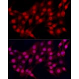Immunofluorescence - Anti-Estrogen Receptor alpha Antibody (A308769) - Antibodies.com