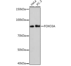 Western Blot - Anti-FOXO3A Antibody [ARC1505] (A308771) - Antibodies.com