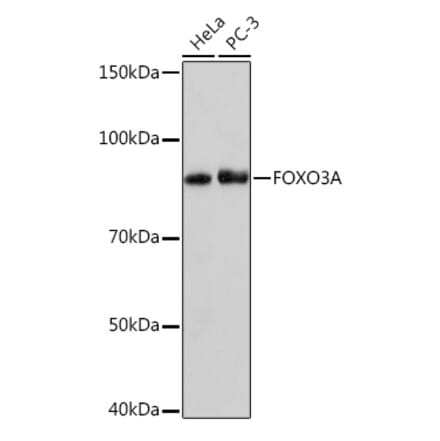 Western Blot - Anti-FOXO3A Antibody [ARC1505] (A308771) - Antibodies.com