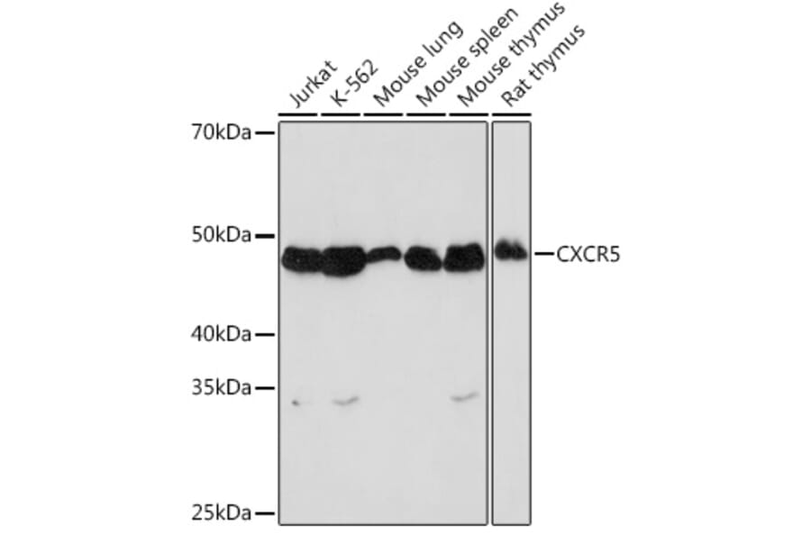 Western Blot - Anti-CXCR5 Antibody [ARC1363] (A308772) - Antibodies.com